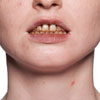 ESMALTE DENTAL